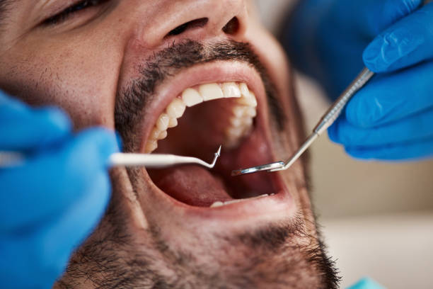 Best Emergency Dentist for Knocked-Out Tooth in Warrenton, OR